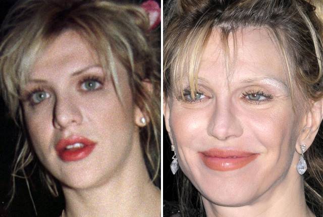 Najgorsze przypadki operacji plastycznych