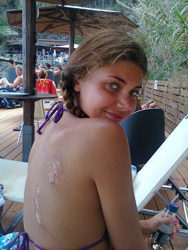 Szpitalne (i powypadkowe) sweet focie gwiazd