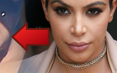 Co się stało z ustami Kim? Powiększyła je w 8 miesiącu ciąży