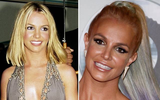 Jak pieniądze zmieniły twarze gwiazd?