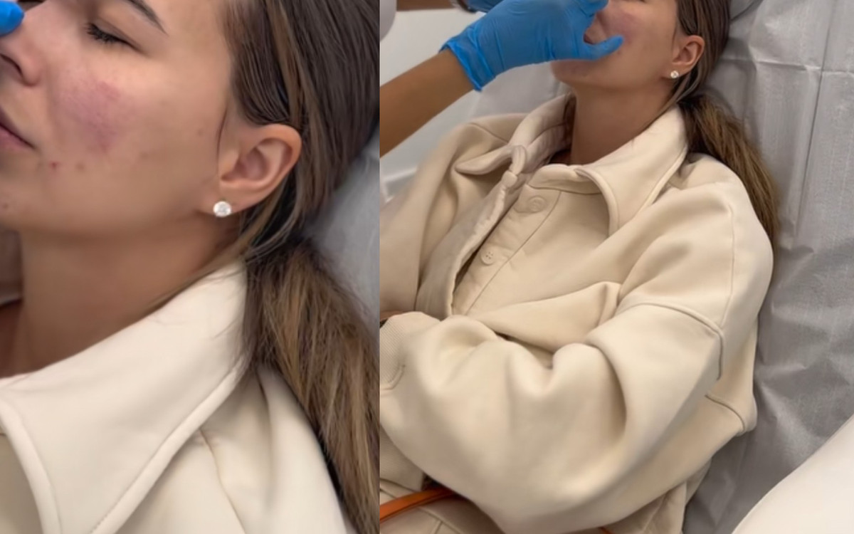 Sandra Kubicka poprawiła urodę. Pokazała, jak zmieniła się jej twarz