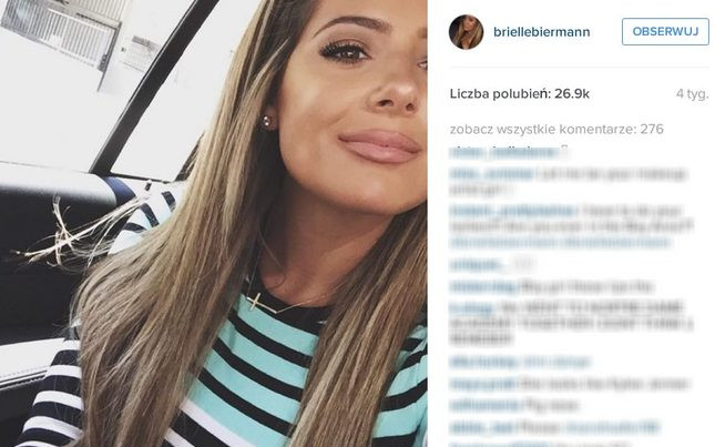 18-letnia córka celebrytki pokazała zabieg powiększenia ust