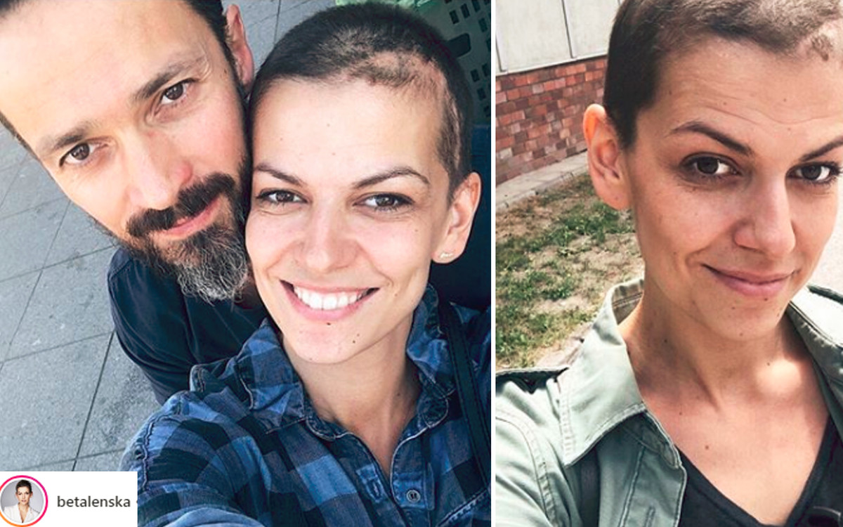 Mocne słowa Lenskej po pęknięciu tętniaka: urodziłam się na nowo