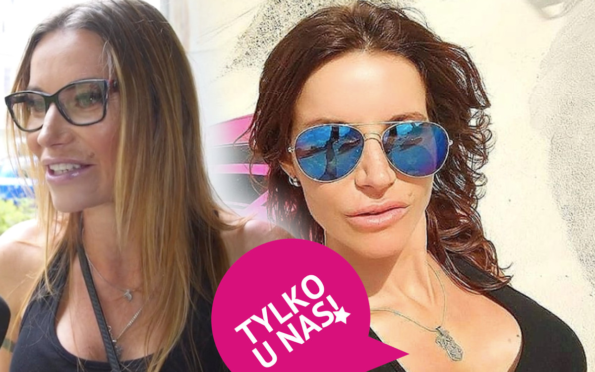 Drifterka, Karolina Pilarczyk o swoich ingerencjach w urodę: “Bardzo lubię medycynę estetyczną”