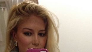 Po 10 operacjach plastycznych może reklamować tylko owoce…