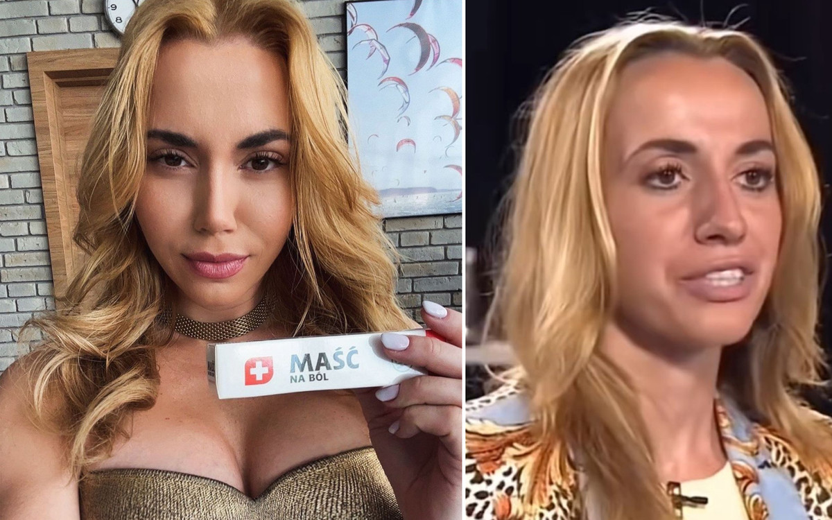 Marianna Schreiber zdradza, jakim zabiegom medycyny estetycznej się poddała!