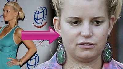 Katastrofa! Co się stało z Jessicą Simpson?! (FOTO)