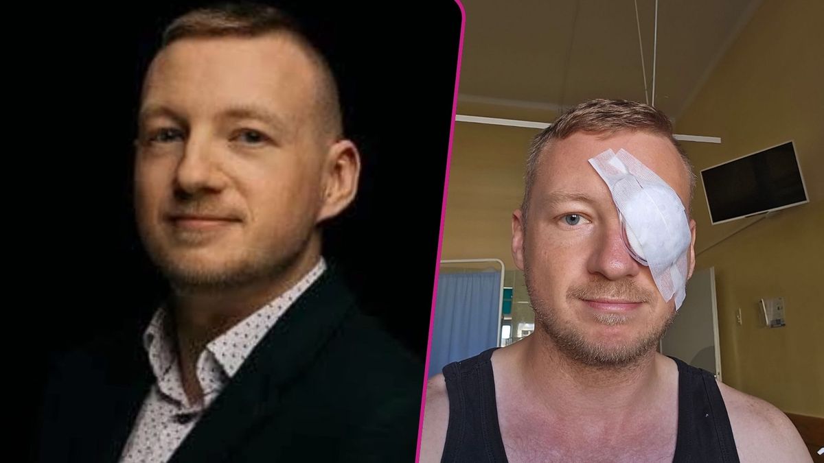 Polski dziennikarz walczy o wzrok po dramatycznym zdarzeniu w Toruniu. Operacja trwała aż 10 godzin!