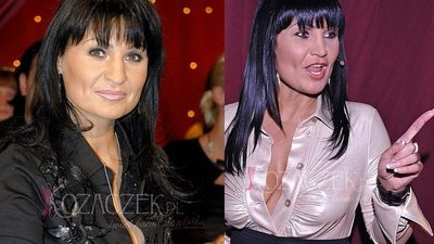 Iwona Pavlović ma nowy nos