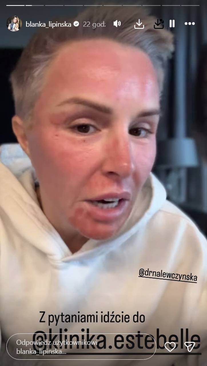 Blanka Lipińska, fot. Instagram