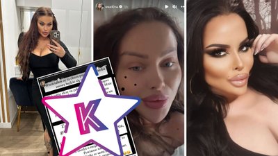 Ewel0na chwali się kolejną operacją i uderza w Esmeraldę Godlewską: “Promujesz klinikę, która ZABIJA ludzi”