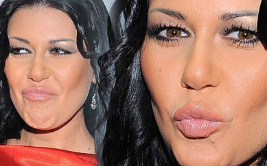 Co Iwona Węgrowska zrobiła z ustami? (FOTO)