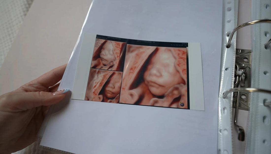 Synek Wersow i Friza, fot. YouTube