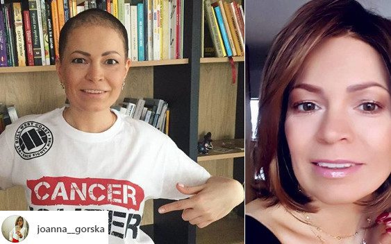 Polska dziennikarka POKONAŁA raka piersi!