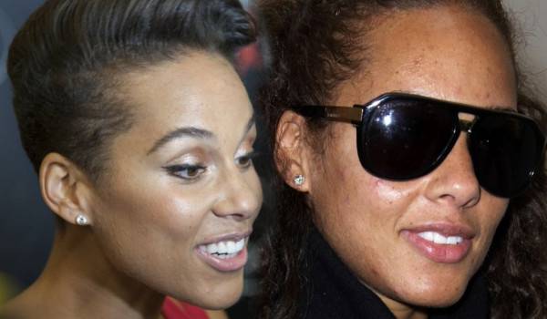 Te gwiazdy borykają się z trądzikiem