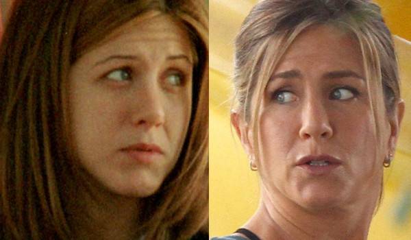 Jak operacja nosa zmieniała twarze gwiazd