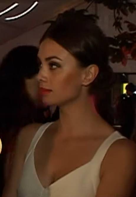 Uczestniczka "Top Model" z blizną. Jak dziś wygląda Anna Koryto?