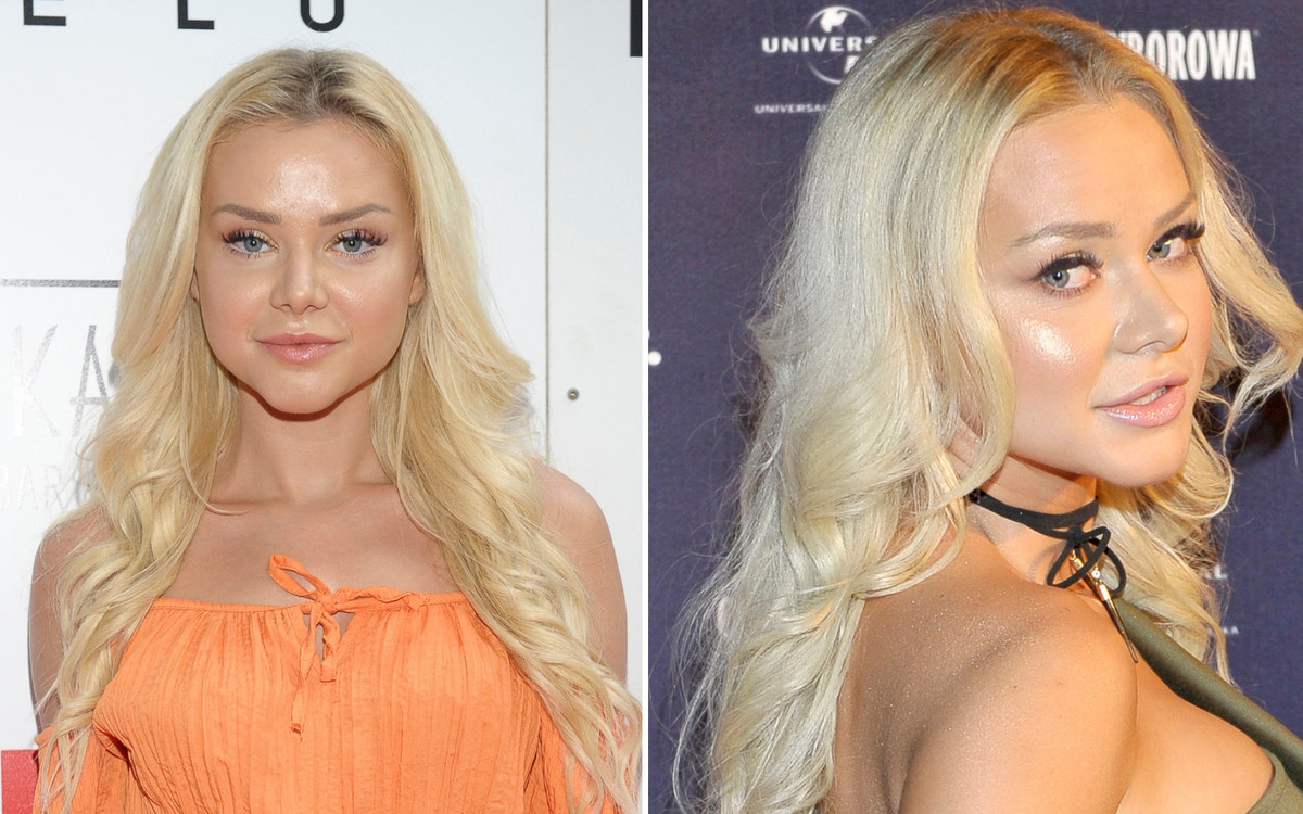 Ciupa odpowiedziała, czy obstrzykiwała BRODĘ i jak się zabezpiecza przez CIĄŻĄ