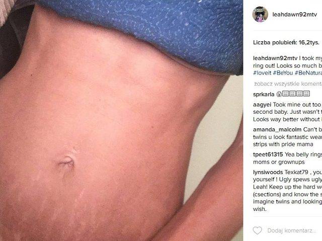 Gwiazdy, które mają rozstępy