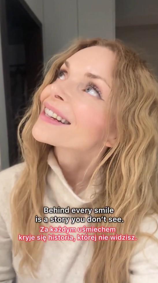 Izabella Miko pokazała prawdziwy uśmiech, fot. Instagram