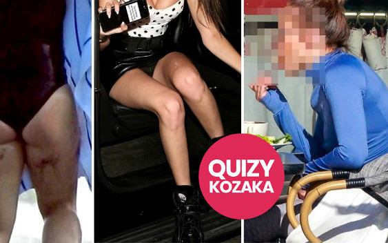 Poznaj GWIAZDĘ na zdjęciach PAPARAZZI (QUIZ)