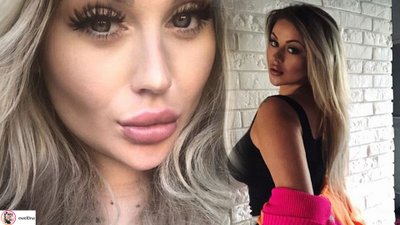 EwelOna pokazała swoje NOWE usta: MASAKRA