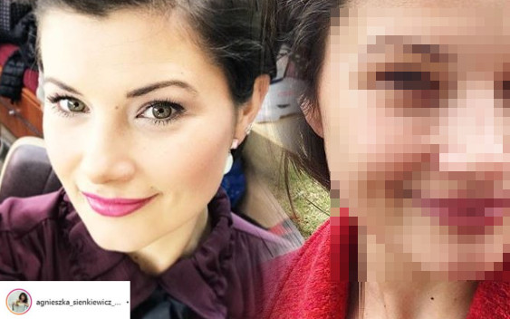 Agnieszka Sienkiewicz mówi STOP! Ostro pojechała po dziewczynach z Instagrama