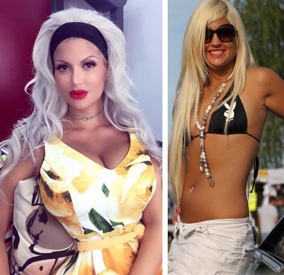 Nie mogła schudnąć, więc wycięła ŻEBRA. Jest szczuplejsza, ale…