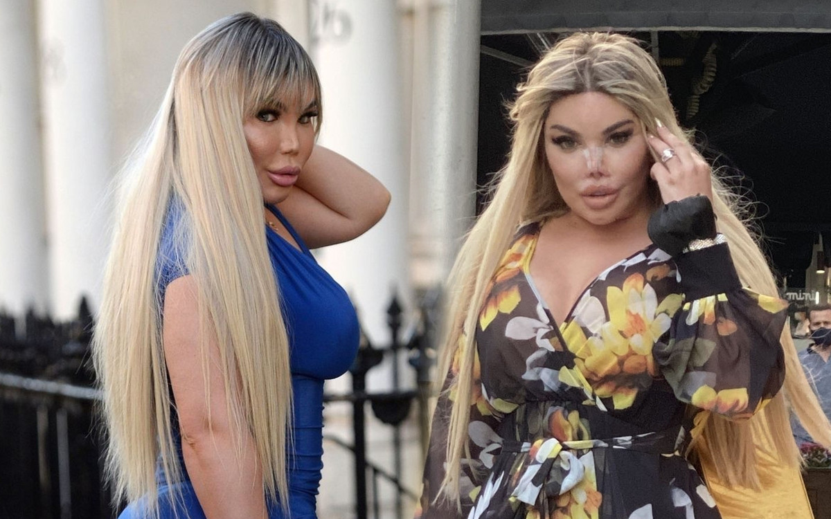 Żywa Barbie, Jessica Alves przeszła KOLEJNĄ operację! Nos poprawiła 12 RAZ