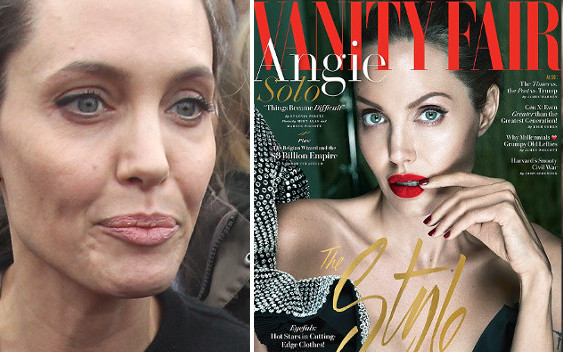 Angelina Jolie przyznała się do choroby, którą widać na twarzy