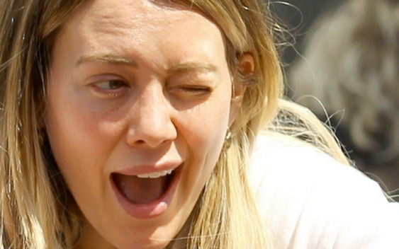 Co się stało z twarzą Hilary Duff?!