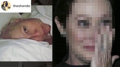 Tak wyglądała w październiku 2016, w ostatnim dniu chemioterapii (ZDJĘCIA)