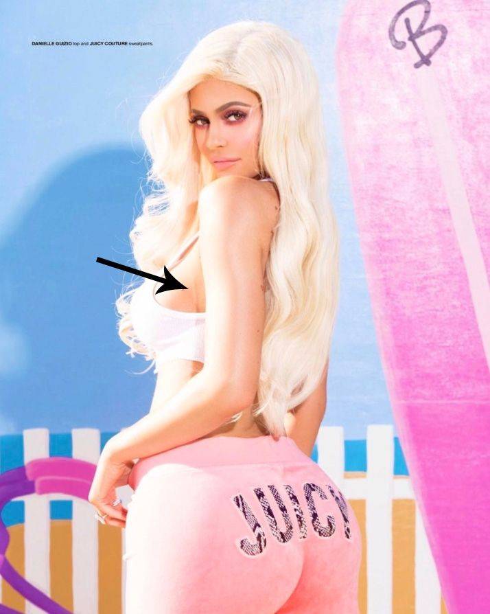 Co oznacza TA BLIZNA na ciele Kylie Jenner? (ZDJĘCIE)