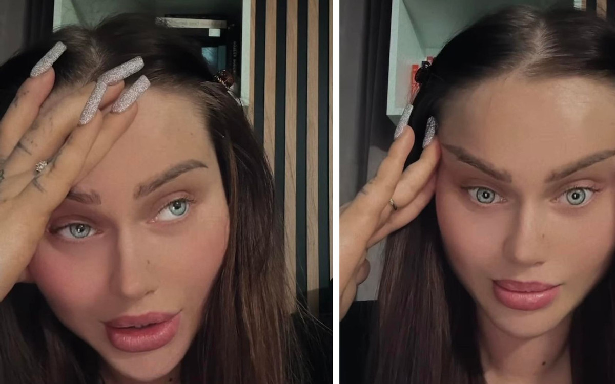 Ewel0na ledwo przeżyła po tureckich operacjach: “Ze mnie lała się ropa, ropa tak śmierdząca”