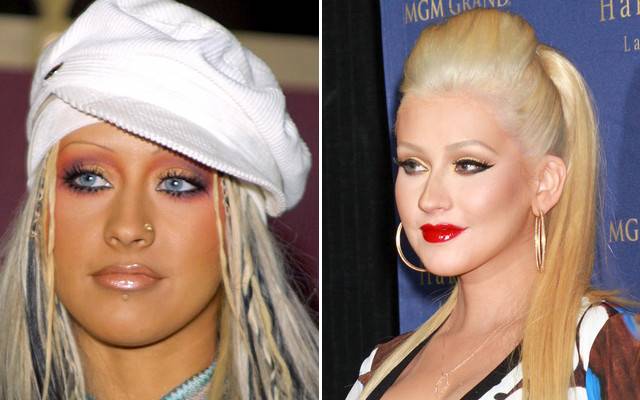 Jak pieniądze zmieniły twarze gwiazd?