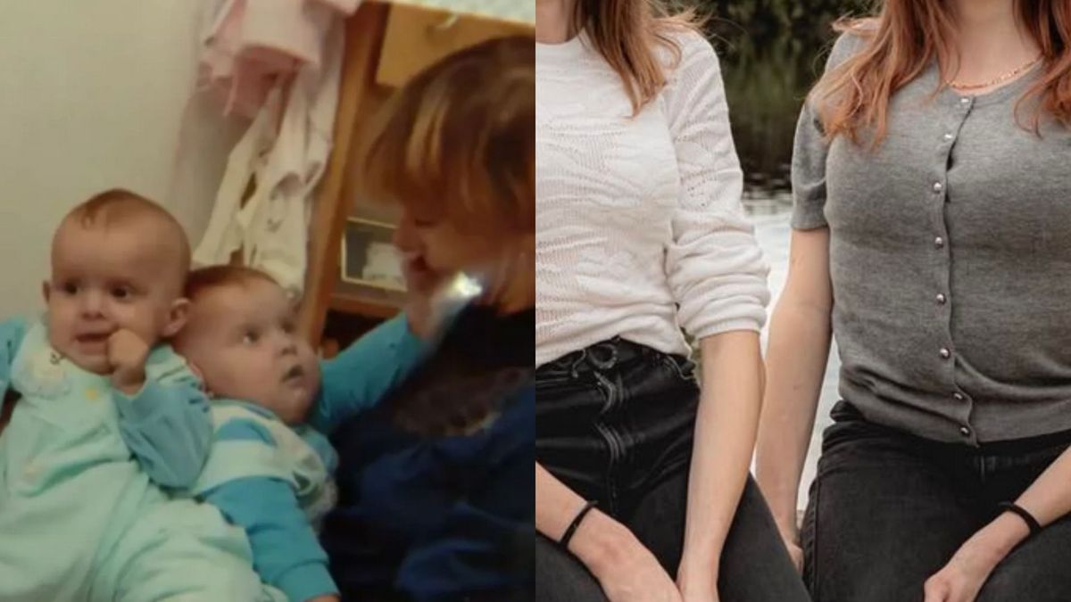 Tak dziś wyglądają polskie bliźnięta syjamskie, fot. Dzień Dobry TVN/Instagram