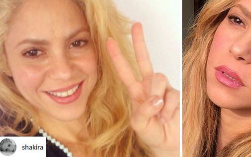 KOSZMAR! Shakira STRACI swoje piękne włosy?