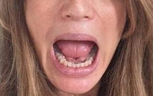 #WakeUpCall następncą Ice Bucket Challenge