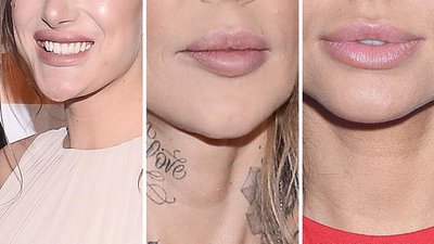 Polskie gwiazdy, które przegięły z POMPOWANIEM ust