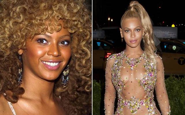 Jak pieniądze zmieniły twarze gwiazd?