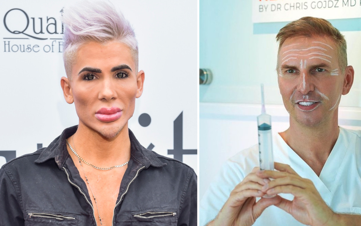 Polski “Żywy Ken”: “Medycyna estetyczna jest dla mnie jak otworzenie rano oczu”. Krzysztof Gojdź OSTRZEGA!