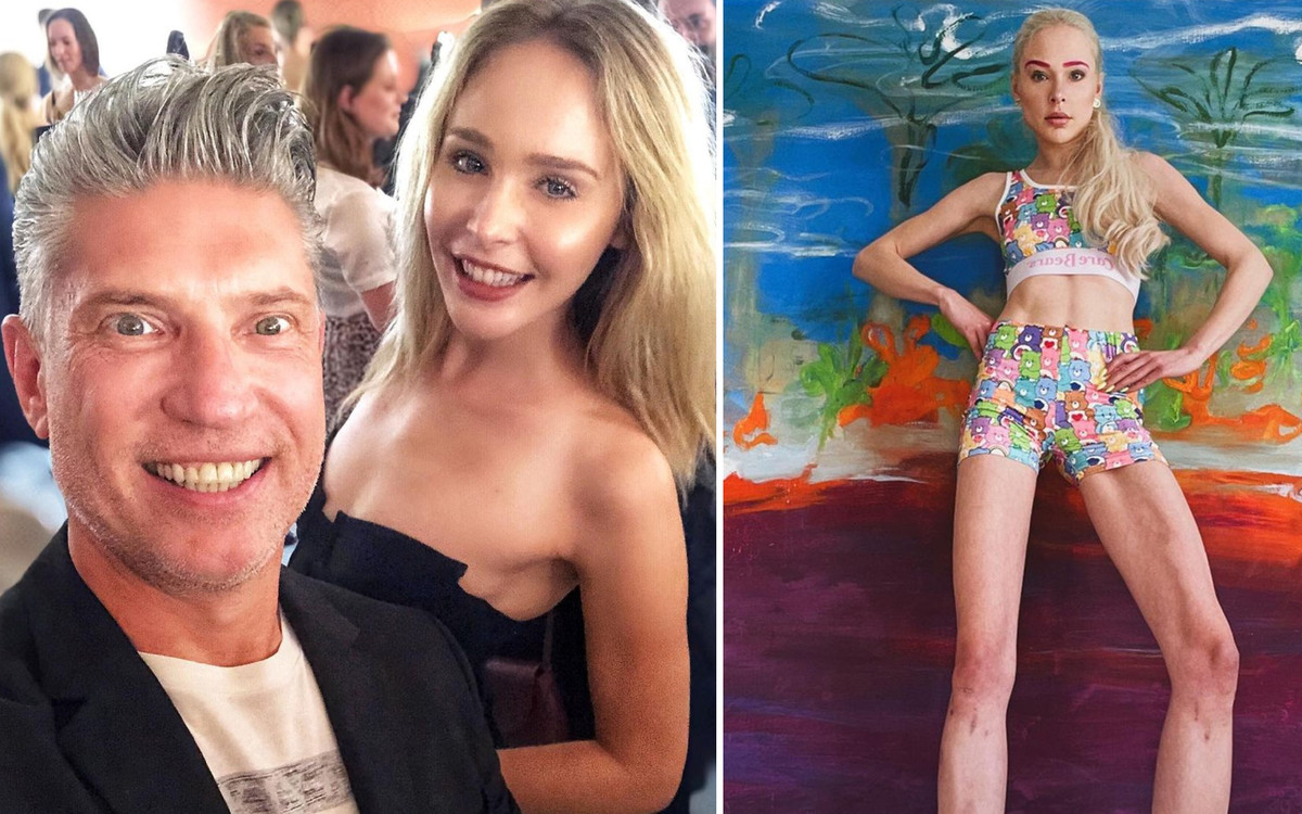 Połamali jej kości za 700 tysięcy złotych. Zrobiła to dla męża, teraz żałuje