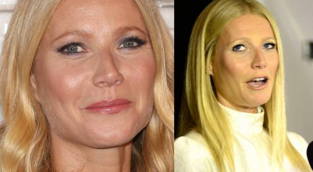 Jakich zabiegów urodowych żałują gwiazdy?