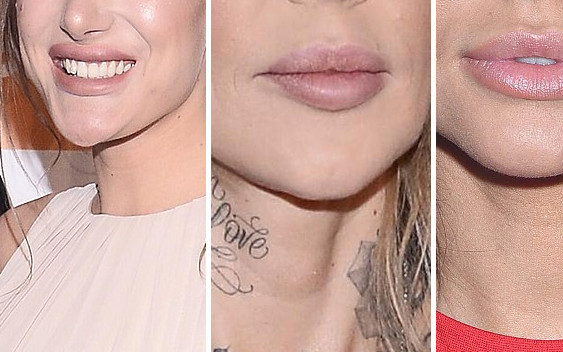 Polskie gwiazdy, które przegięły z POMPOWANIEM ust