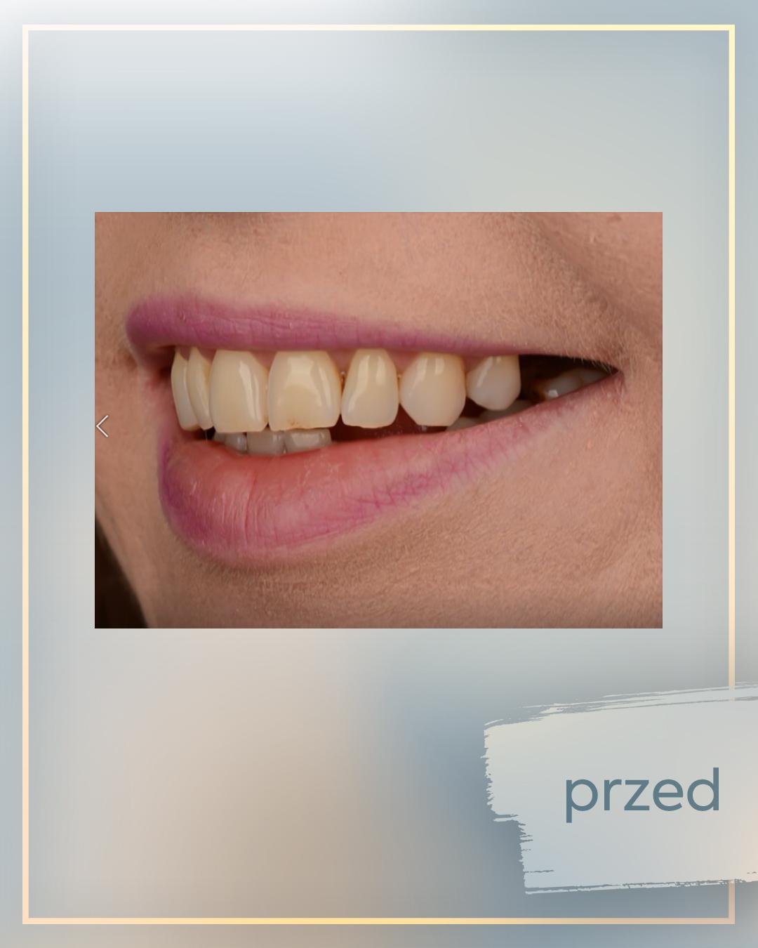 Emilia Plenski przed metamorfozą w "Bez Kompleksów", fot. Instagram