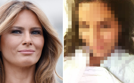 Zrobiła sobie szereg operacji plastycznych, żeby wyglądać jak Melania Trump