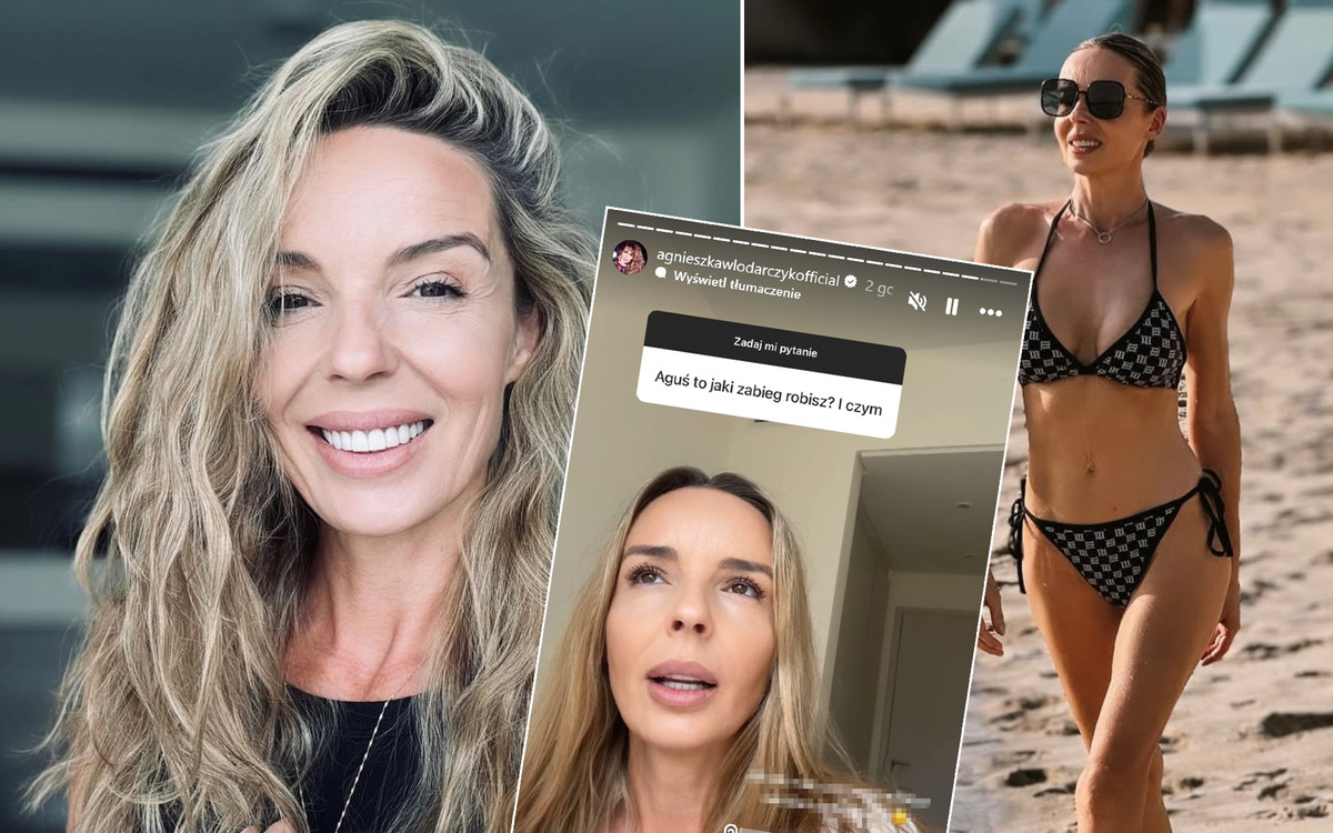 Agnieszka Włodarczyk relacjonuje wyprawę do gabinetu medycyny estetycznej i zapowiada: “Nie będe się starzeć z godnością”