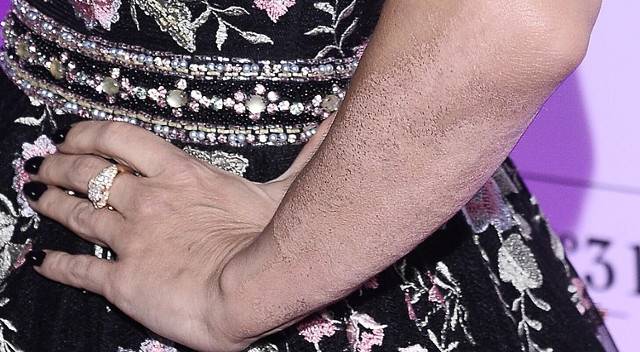 Tak wygląda ręka Dody po usunięciu dużego tatuażu (ZDJĘCIA)