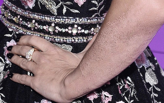 Tak wygląda ręka Dody po usunięciu dużego tatuażu (ZDJĘCIA)