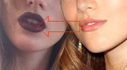 Gwiazdy podejrzewane o powiększenie ust